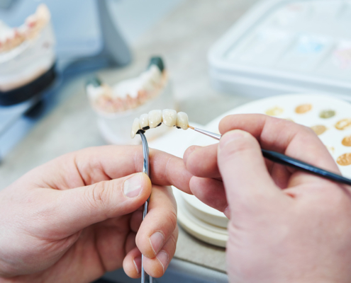 Bearbeitung einer Zahnprothese